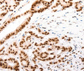 CASP9 (active) Polyclonal Antibody – Figure 1 of 3