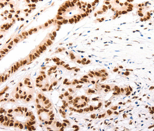 CASP9 (active) Polyclonal Antibody – Figure 1 of 3