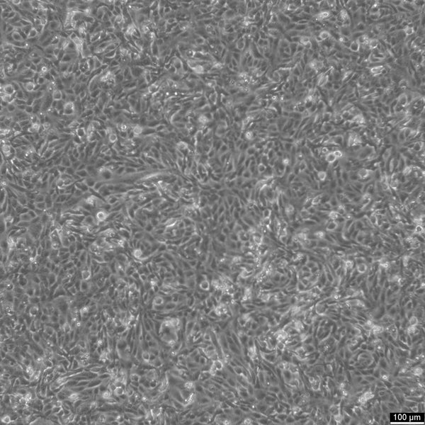 143B cell