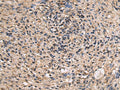 ITIH2 Polyclonal Antibody – Figure 1 of 2