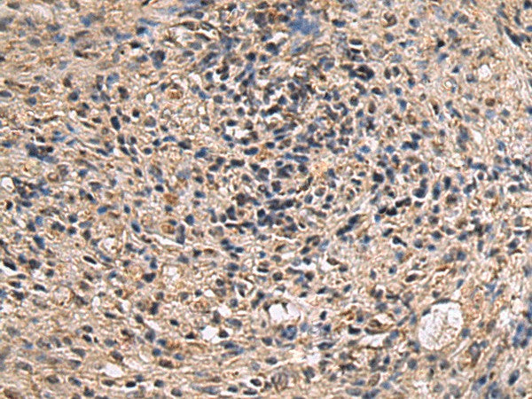 ITIH2 Polyclonal Antibody – Figure 1 of 2