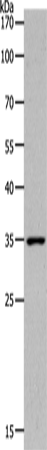 MC2R Polyclonal Antibody – Figure 1 of 2