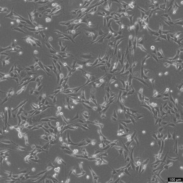15P-1 cell