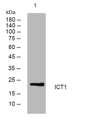 ICT1 Rabbit Polyclonal Antibody – Figure 1 of 1