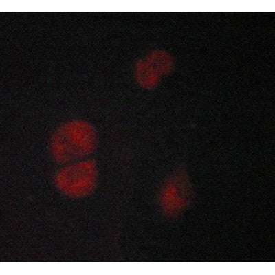 ADRB2 Antibody – Figure 1 of 4