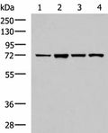 ZAP70 Polyclonal Antibody – Figure 1 of 3