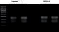 Figure 1. Electrophoresis of E. coli RNA extraction products