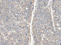 THAP10 Polyclonal Antibody – Figure 1 of 2