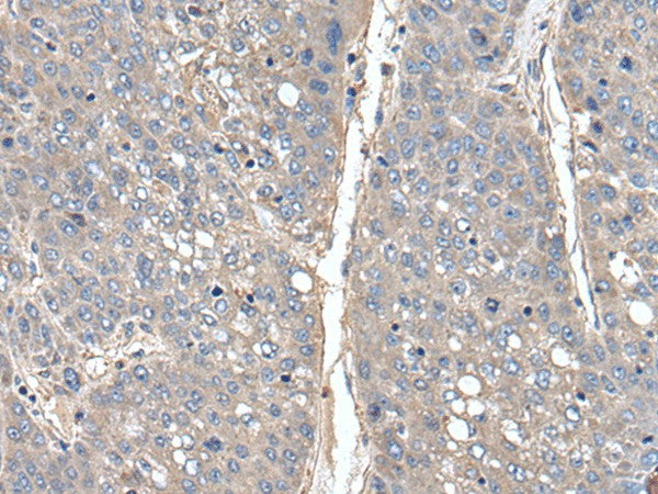THAP10 Polyclonal Antibody – Figure 1 of 2