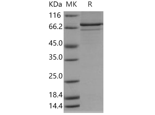 Recombinant Human MAPKAPK5 Protein (His & GST Tag) – Figure 1 of 2