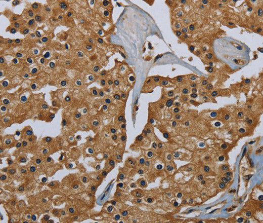 GBP5 Polyclonal Antibody – Figure 1 of 3