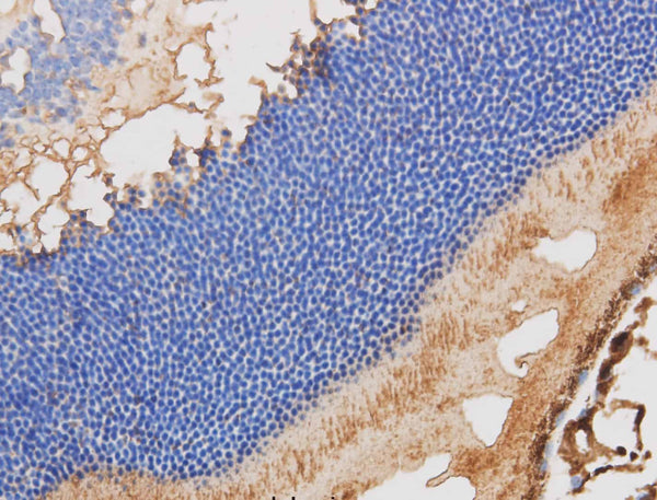 RBP3 Polyclonal Antibody – Figure 1 of 3