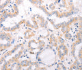 CIDEB Polyclonal Antibody – Figure 1 of 3
