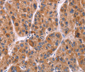 Ephrin A5 Polyclonal Antibody – Figure 1 of 3