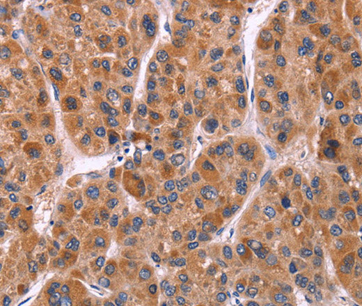 Ephrin A5 Polyclonal Antibody – Figure 1 of 3