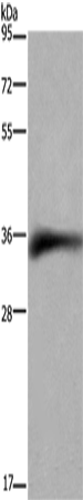 CD32 Polyclonal Antibody – Figure 1 of 3