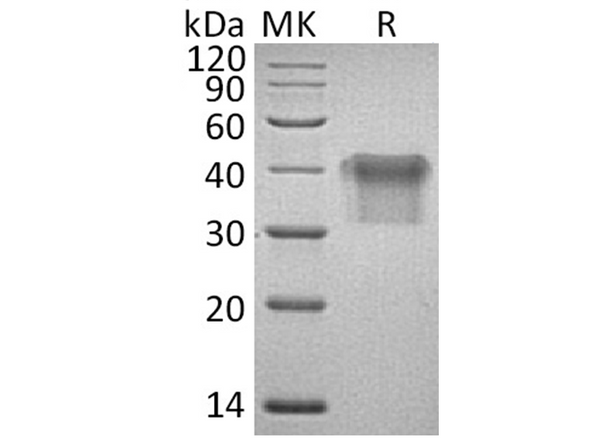 Recombinant Human IL2Ra/CD25 Protein (His Tag) – Figure 1 of 2
