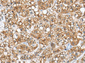 PHLDA3 Polyclonal Antibody – Figure 1 of 3