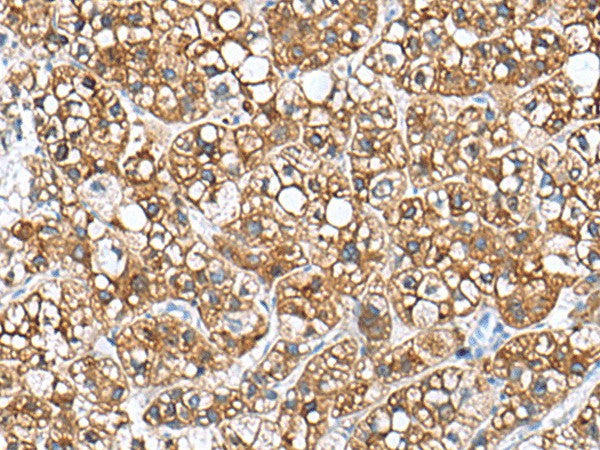 PHLDA3 Polyclonal Antibody – Figure 1 of 3