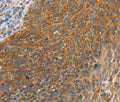 ERK 3 Polyclonal Antibody – Figure 1 of 3