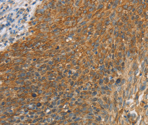 ERK 3 Polyclonal Antibody – Figure 1 of 3
