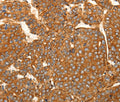 SFRP1 Polyclonal Antibody – Figure 1 of 3