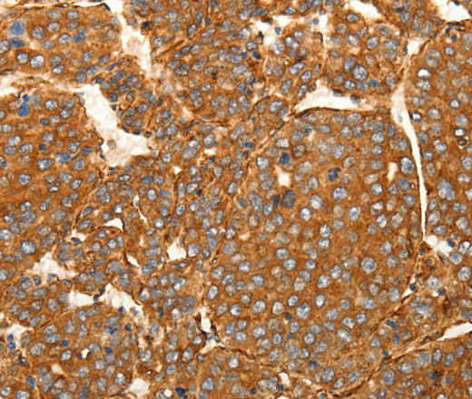 SFRP1 Polyclonal Antibody – Figure 1 of 3