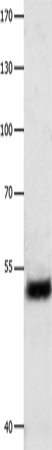 EEF1 gamma Polyclonal Antibody – Figure 1 of 3