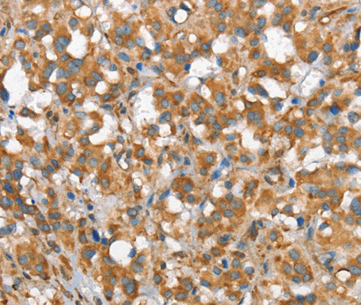 CSMD1 Polyclonal Antibody – Figure 1 of 3