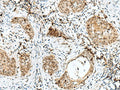 RBM15 Polyclonal Antibody – Figure 1 of 3