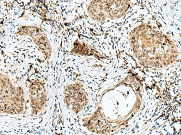 RBM15 Polyclonal Antibody – Figure 1 of 3