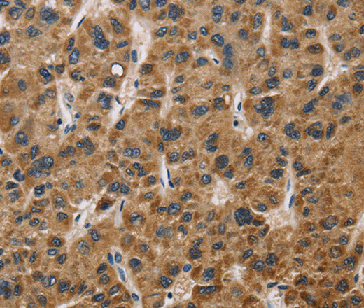IL19 Polyclonal Antibody – Figure 1 of 5
