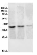 AIMP2 Polyclonal Antibody – Figure 1 of 2