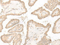 DCD Polyclonal Antibody – Figure 1 of 2