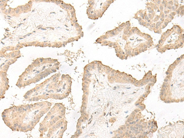 DCD Polyclonal Antibody – Figure 1 of 2