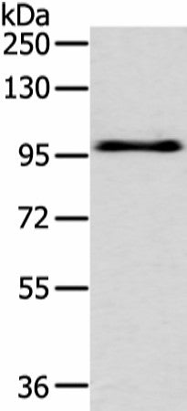 EPHA3 Polyclonal Antibody – Figure 1 of 2