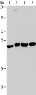 CCR6 Polyclonal Antibody – Figure 1 of 3
