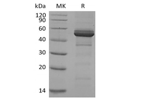 Recombinant Human TACI/TNFRSF13B/CD267 (C-Fc) – Figure 1 of 2