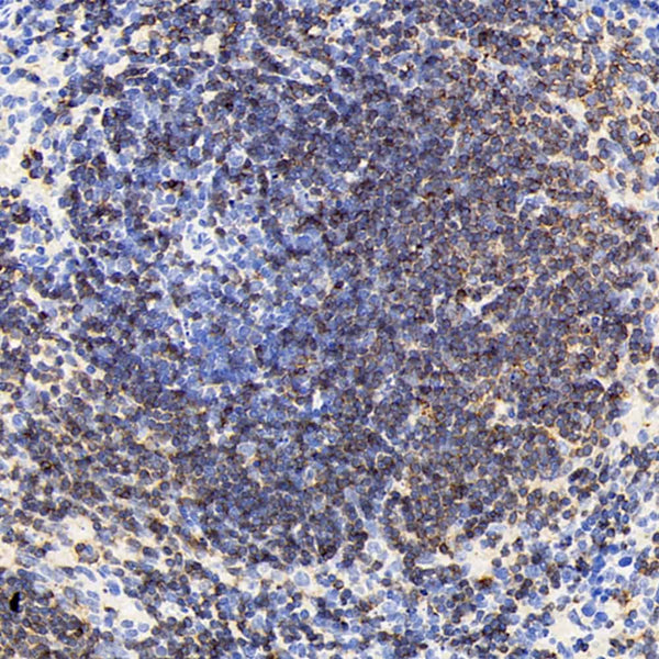 CD19 Polyclonal Antibody – Figure 1 of 3