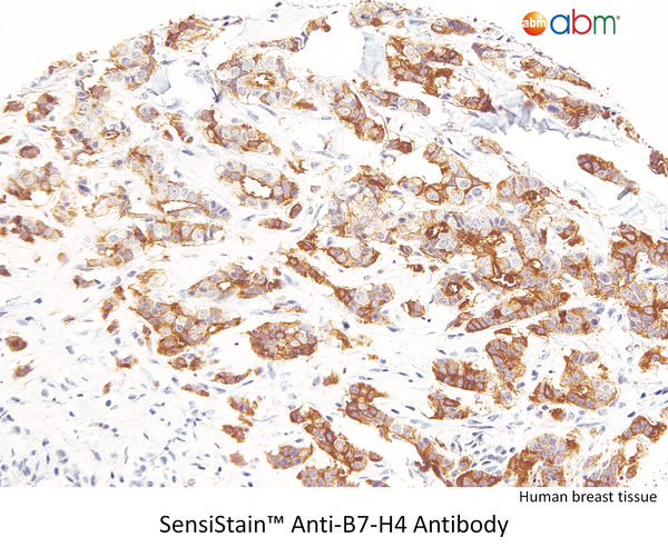 SensiStain™ Anti-B7-H4 Antibody – Figure 1 of 1
