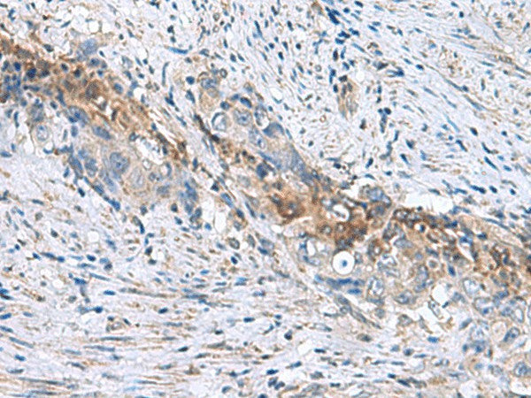 RNF208 Polyclonal Antibody – Figure 1 of 3