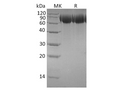 Recombinant Human TrkB/NTRK2 Protein (His Tag) – Figure 1 of 2