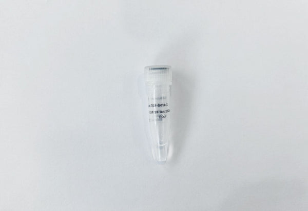 2019-nCoV NP Antibody (6G9)