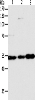 GSR Polyclonal Antibody – Figure 1 of 4
