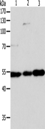 GSR Polyclonal Antibody – Figure 1 of 4