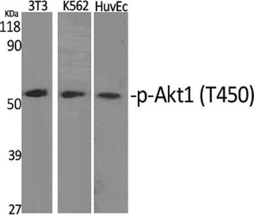 Phospho-AKT1 (Thr450) Polyclonal Antibody – Figure 1 of 2