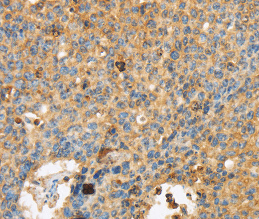 ERK 3 Polyclonal Antibody – Figure 1 of 2