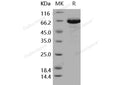 Recombinant Human EphB6 Protein (His Tag) – Figure 1 of 2