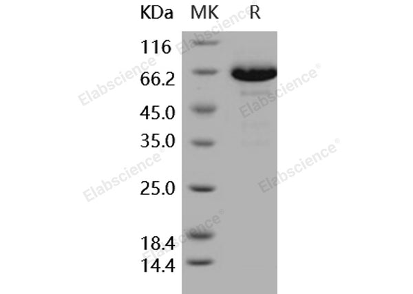 Recombinant Human EphB6 Protein (His Tag) – Figure 1 of 2