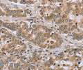 CLEC16A Polyclonal Antibody – Figure 1 of 2